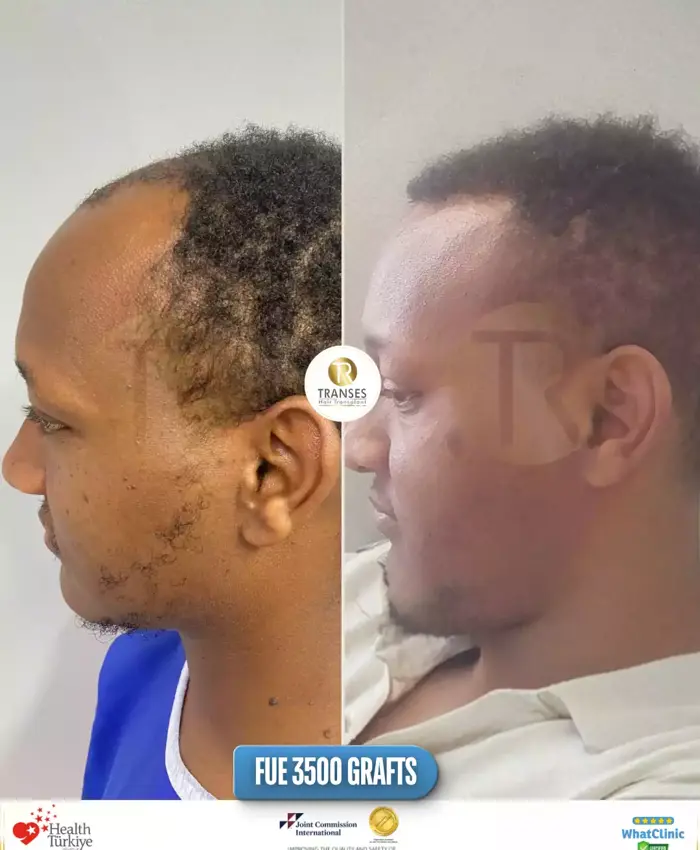 Before & After