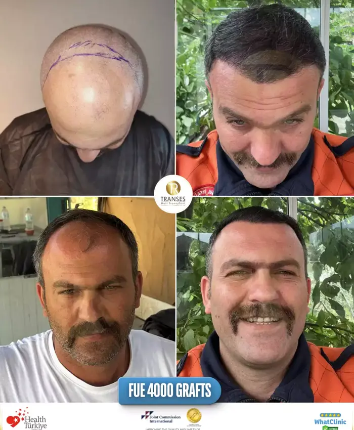 Before & After