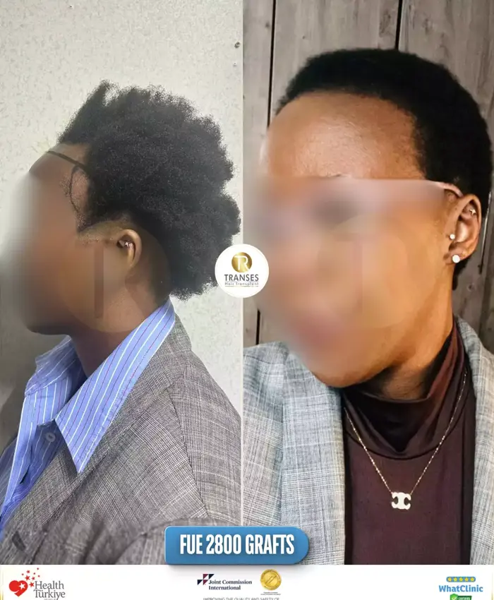 Before & After
