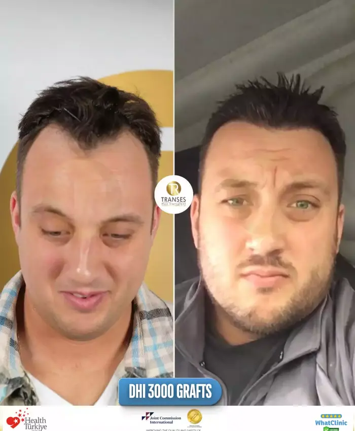 Before & After