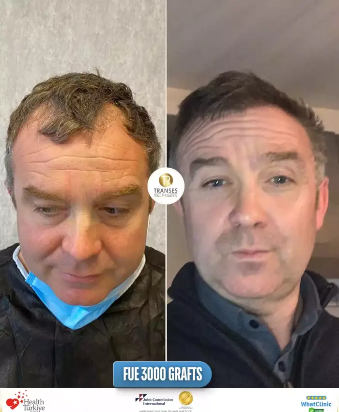 Before & After