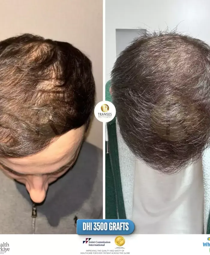 Before & After