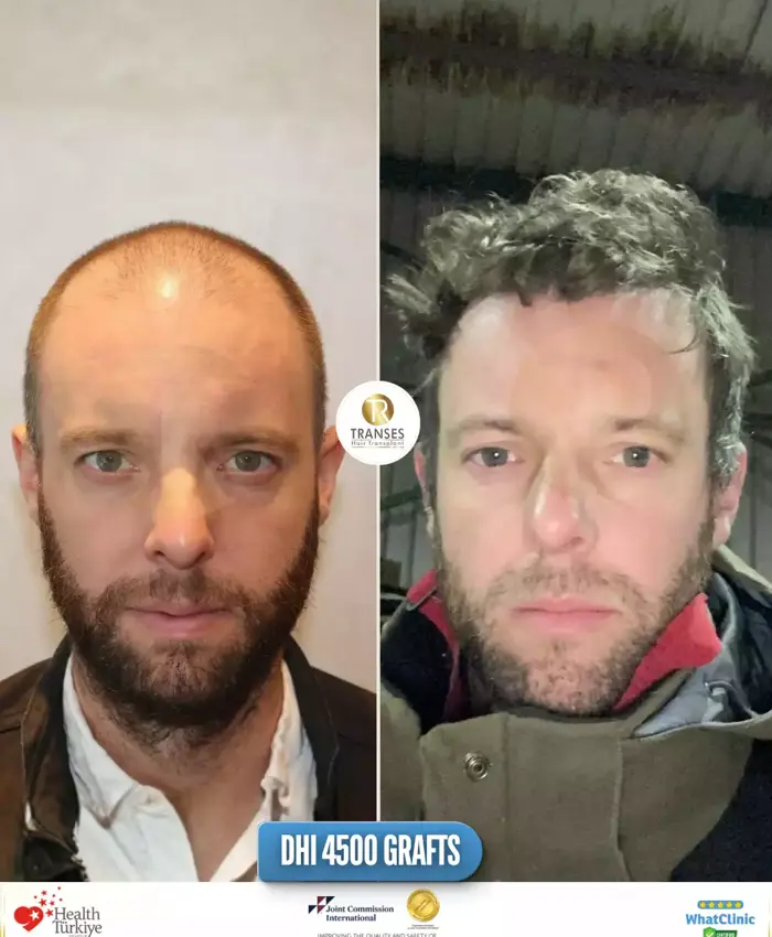 Before & After