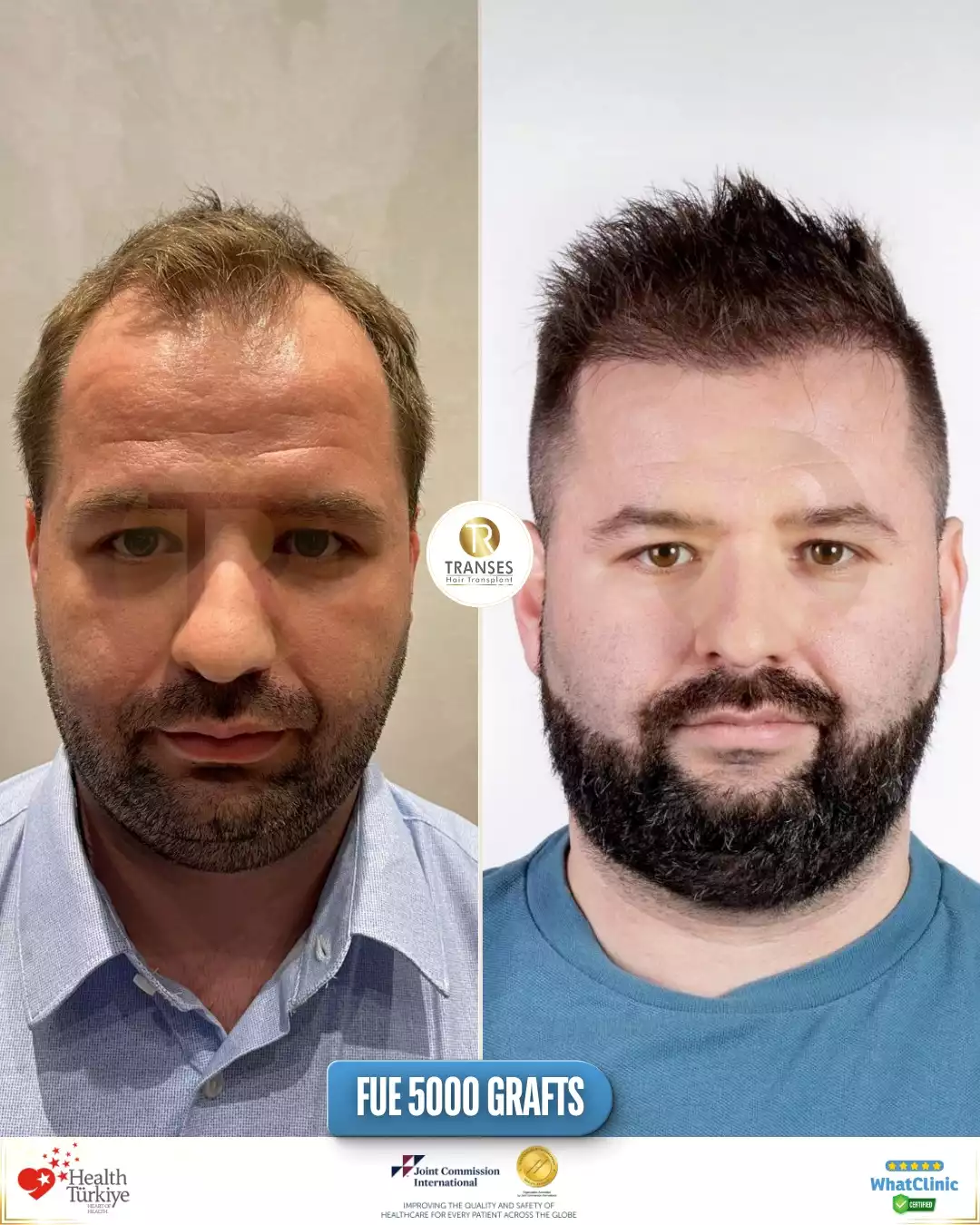 before - after