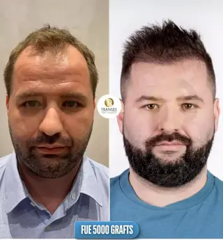 before - after