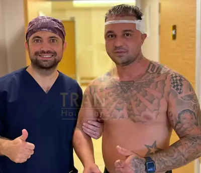 No Shave Hair Transplant