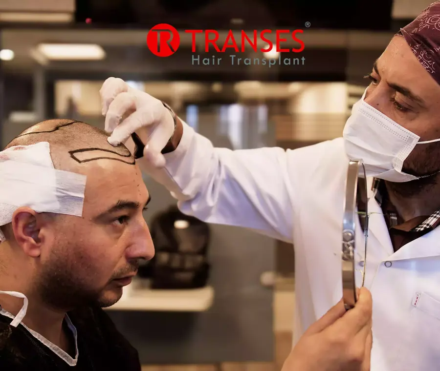 Sapphire FUE Hair Transplant